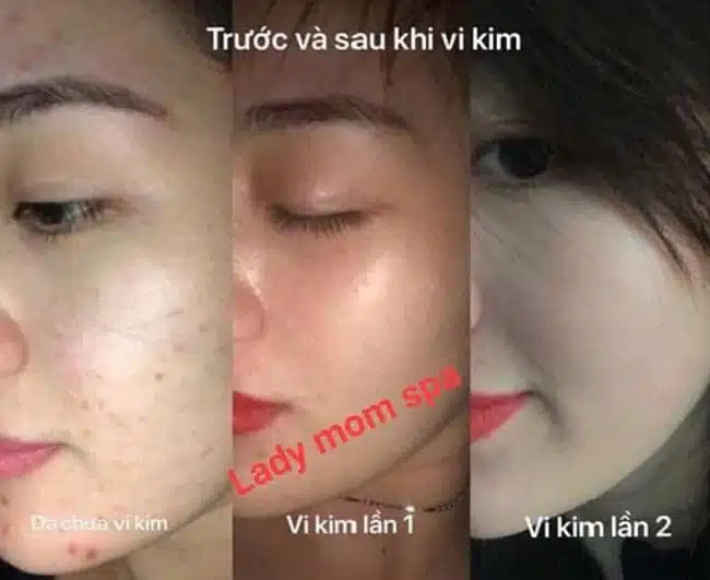 Lady Mom Spa điểm đến hàng đầu kết hợp giữa làm đẹp và thư giãn đảm bảo sự hài lòng của khách hàng.