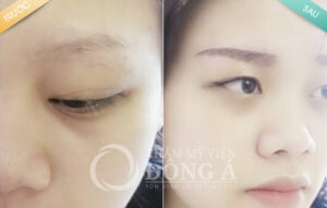Thẩm mỹ viện Đông Á