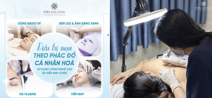 Hiền Anh Clinic mang đến các gói dịch vụ chất lượng giúp khách hàng có một trãi nghiệm làm đẹp tốt nhất.