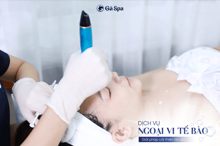 Gà Spa – Spa trị mụn uy tín, giá hợp lý
